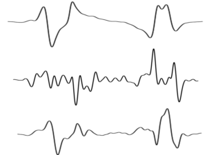 Classificazione delle serie temporali per il rilevamento della fatica nei corridori: un tutorial |  di K Bahavathy |  Dicembre 2023

 | Intelligenza-Artificiale