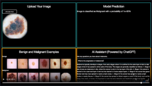 Crea un prodotto basato sull'intelligenza artificiale con visione artificiale e ChatGPT

 | Intelligenza-Artificiale