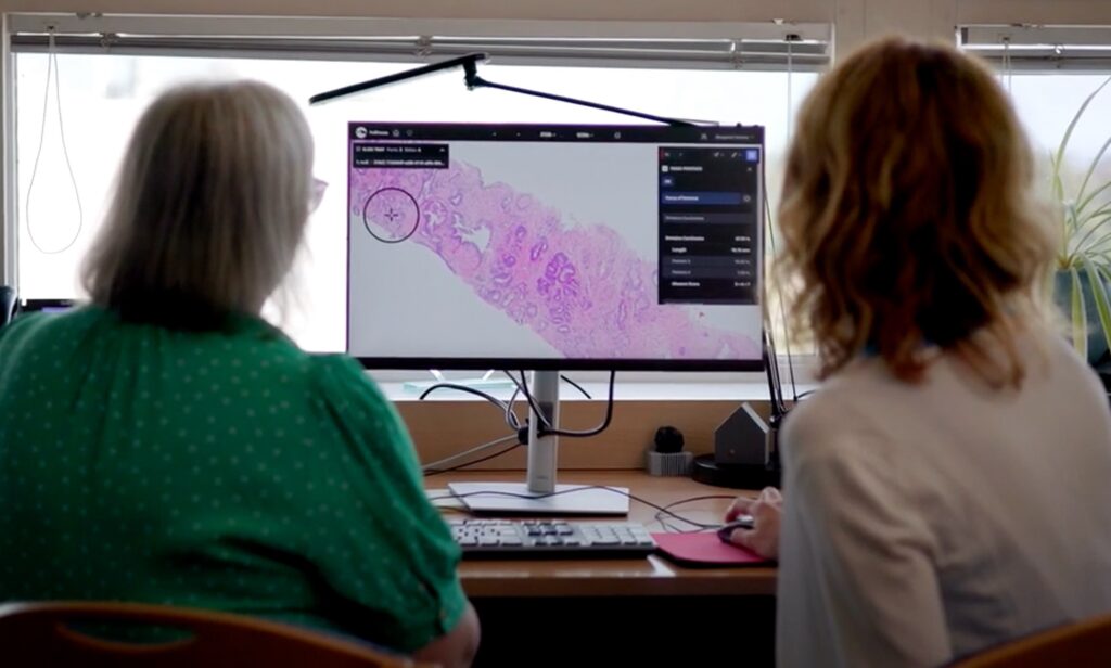 Gli ospedali del Regno Unito avviano la sperimentazione in diretta dell'intelligenza artificiale per il rilevamento del cancro alla prostata

 | Intelligenza-Artificiale