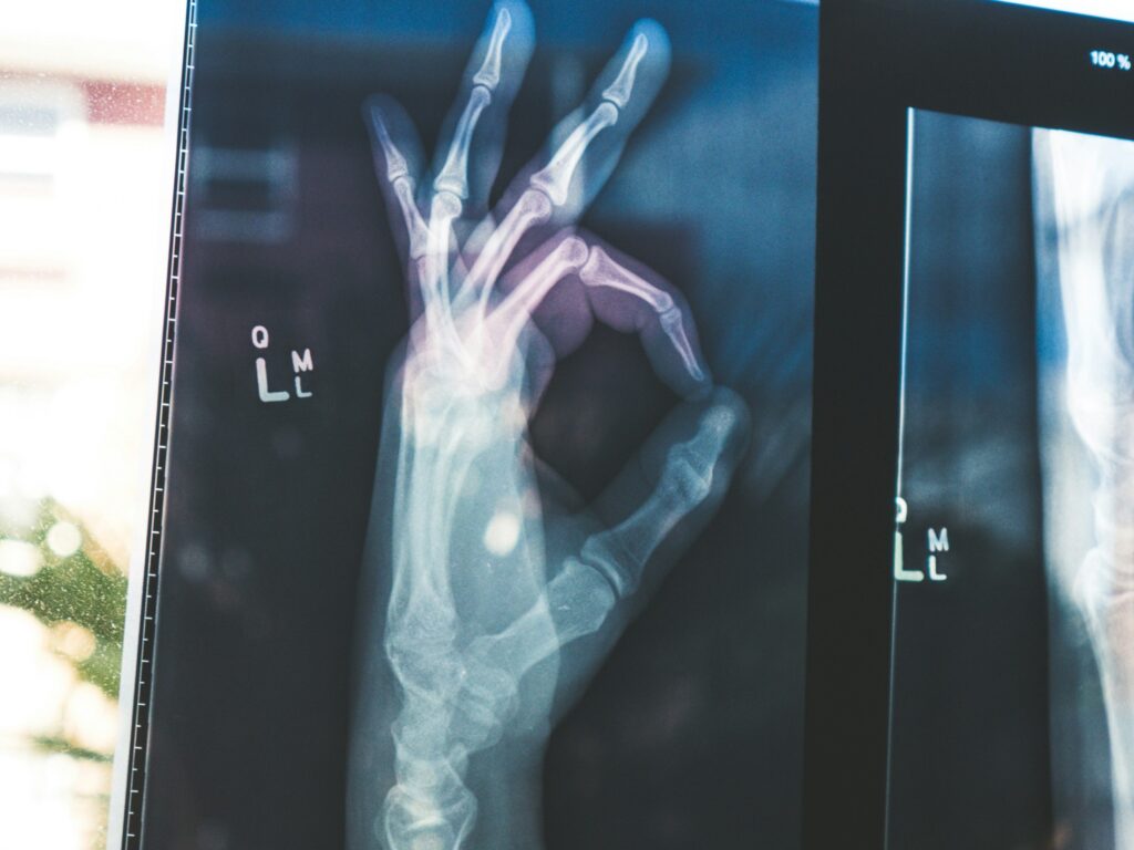 I modelli AI Open Medgemma Open di Google potrebbero trasformare l'assistenza sanitaria

 | Intelligenza-Artificiale